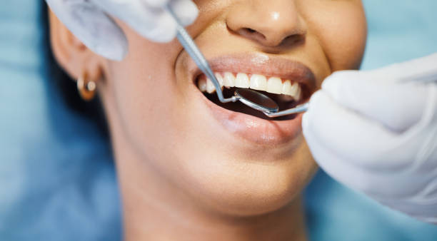Best Emergency Tooth Extraction in Blackville, SC