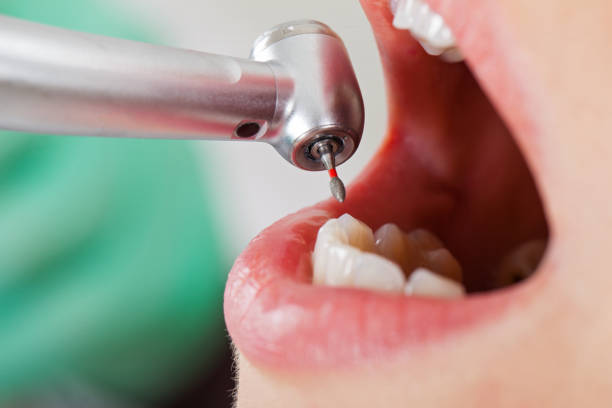 Best Emergency Broken Tooth Repair in Blackville, SC